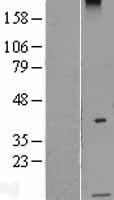GUSBP15 Human Over-expression Lysate