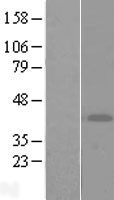 ART4 Human Over-expression Lysate