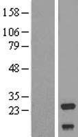 NDUFV2 Human Over-expression Lysate