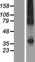 XK Human Over-expression Lysate