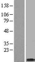 Thymosin beta 4 (TMSB4X) Human Over-expression Lysate