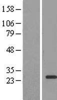 EEF1B2 Human Over-expression Lysate