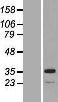 MPST Human Over-expression Lysate