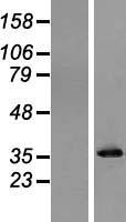 Pyrophosphatase 1 (PPA1) Human Over-expression Lysate
