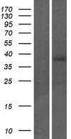 TP53INP2 Human Over-expression Lysate
