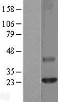 Claudin 6 (CLDN6) Human Over-expression Lysate