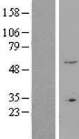 ZNF77 Human Over-expression Lysate