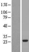 PCTP Human Over-expression Lysate