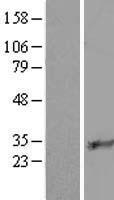 MASA (ENOPH1) Human Over-expression Lysate