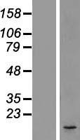OSTC Human Over-expression Lysate