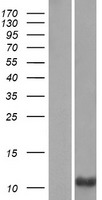PRM3 Human Over-expression Lysate