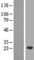 IFNA17 Human Over-expression Lysate