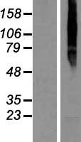 PGAP6 Human Over-expression Lysate