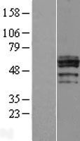 CHST6 Human Over-expression Lysate