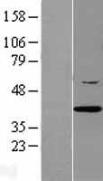 ZNF350 Human Over-expression Lysate