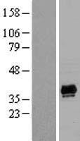 PDLIM2 Human Over-expression Lysate