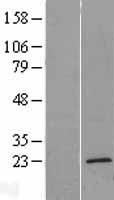 TMEM35 (TMEM35A) Human Over-expression Lysate