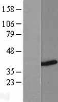 HNRPH3 (HNRNPH3) Human Over-expression Lysate