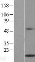 IL21 Human Over-expression Lysate
