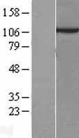 Sec8 (EXOC4) Human Over-expression Lysate