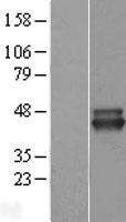 ALS2CR1 (NIF3L1) Human Over-expression Lysate