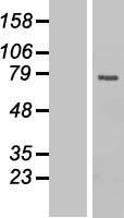 CDC25B Human Over-expression Lysate
