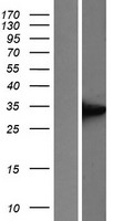 UCP1 Human Over-expression Lysate