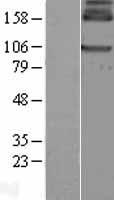 GABA B Receptor 1 (GABBR1) Human Over-expression Lysate