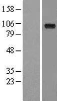 FOXM1 Human Over-expression Lysate