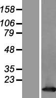 Tcl1 (TCL1A) Human Over-expression Lysate