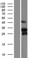 HAND2 Human Over-expression Lysate