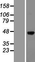 SPHK1 Human Over-expression Lysate
