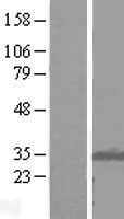 ITM2B Human Over-expression Lysate