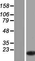 TMSB15A Human Over-expression Lysate