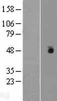 CSNK1G1 Human Over-expression Lysate
