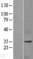 CXCL16 Human Over-expression Lysate