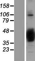SNAP-beta (NAPB) Human Over-expression Lysate