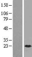 DUSP21 Human Over-expression Lysate