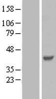 Parvin gamma (PARVG) Human Over-expression Lysate