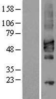 CRLF2 Human Over-expression Lysate