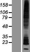 HRH2 Human Over-expression Lysate