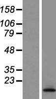 TCTA Human Over-expression Lysate