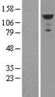 MDA5 (IFIH1) Human Over-expression Lysate