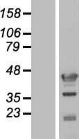 C17orf75 Human Over-expression Lysate