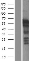 LHX5 Human Over-expression Lysate