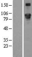 LEPRE1 (P3H1) Human Over-expression Lysate
