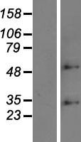 ZDHHC6 Human Over-expression Lysate