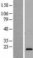 Placental lactogen (CSH2) Human Over-expression Lysate