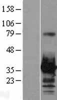 HOXC8 Human Over-expression Lysate