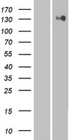 HIPK2 Human Over-expression Lysate